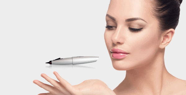 CryoPen Cryotherapy Willesden