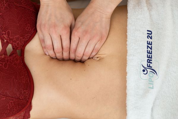 diastasis recti treatment Willesden