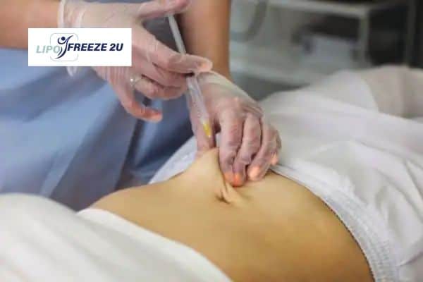 How Does Aqualyx Fat Dissolving Injection Work to Break Down Fat Willesden?