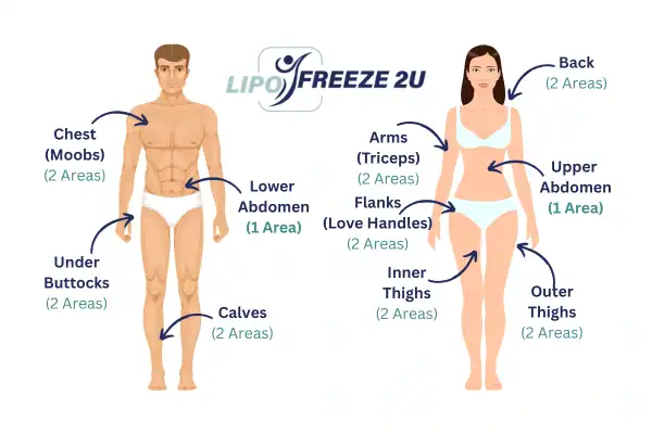Areas you can have fat freezing treatment Willesden