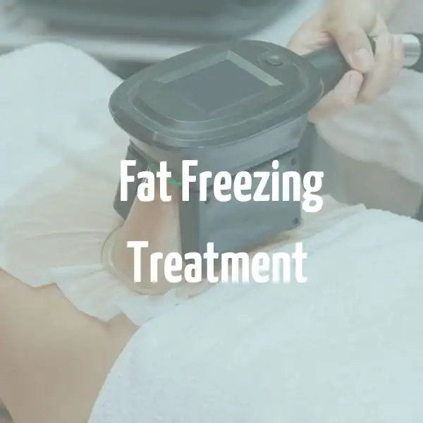 fat freezing treatment Willesden
