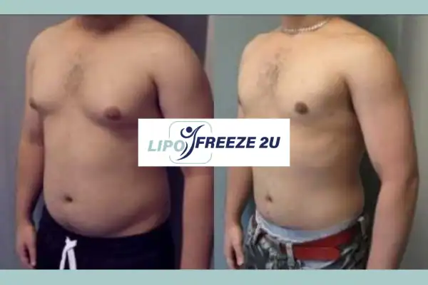 How Long Does It Take to See Results Willesden?