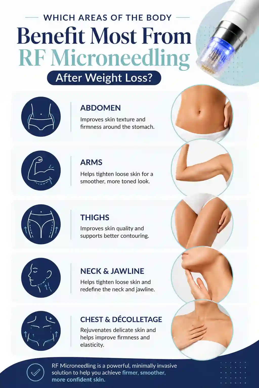 Which Areas of the Body Benefit Most From RF Microneedling After Weight Loss Willesden